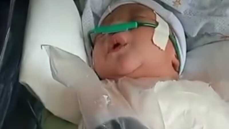 Recém-nascido aparece com hematomas e com fratura no braço, enrolado em saco plastico após parto no hospital de Itupiranga